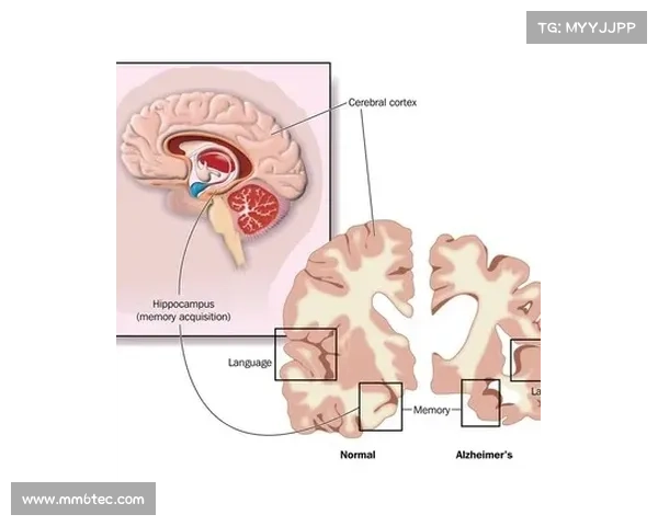 脑辐射治疗攻略:科学有效的方法大揭秘 脑辐射治疗攻略:科学有效的方法大揭秘